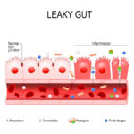 3 Ways to Heal Your Leaky Gut