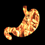 3 Simple Steps to End Heartburn and Acid Reflux
