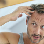 Is Your Hair Loss Thyroid Related?