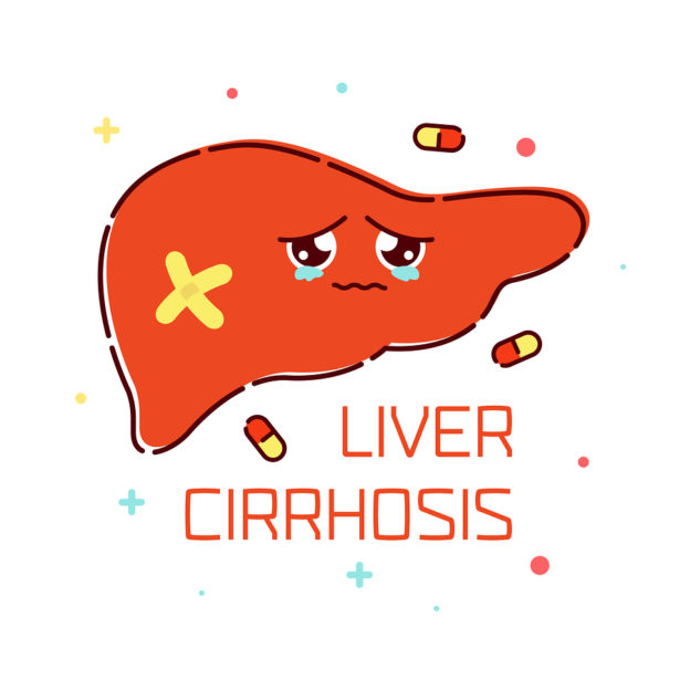 liver cirrhosis, alcohol and non-related alcohol fatty liver disease, NAFLD, non-alcoholic fatty liver disease symptoms, how can I tell if I have NAFLD?, NAFLD symptoms, how liver is affected by alcohol and/or poor diet