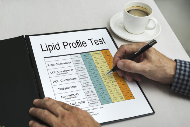 blood test, HDL, LDL, cholesterol score, cholesterol numbers, more important than cholesterol, lipid profile test